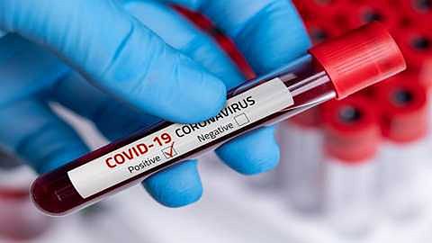 In 51 percent of the population proved to have antibodies In five corona-affected wards of Pune