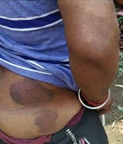 chandgad Police beat up