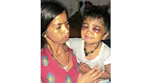 अडीच वर्षांच्या चिमुरड्याला शिक्षिकेची अमानुष मारहाण