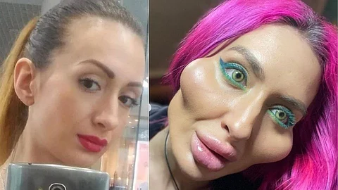 ukrainian model anastasia pokreshchuk world biggest cheeks has shared a picture before cosmetic surgeries
