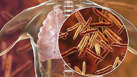 Corona reduced the incidence of leprosy and tuberculosis