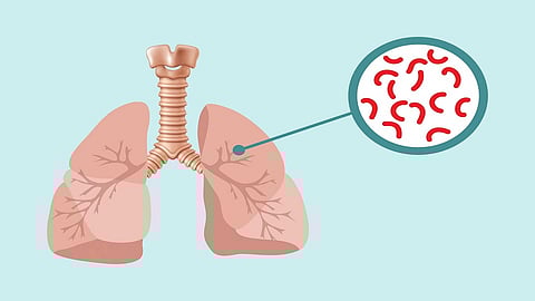 The Number Of TB Patients In The District Has Halved Kolhapur Marathi News