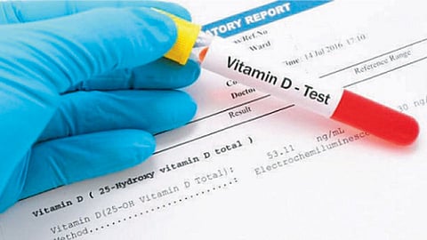 Vitamin-D