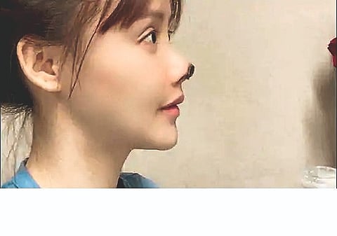 china actress wrong nose surgery social media photo