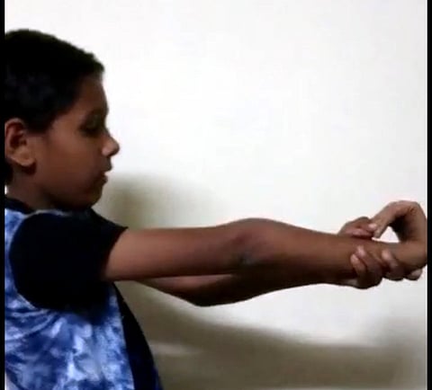 अहो आश्चर्यम...! बोटे मनगटाला टेकविण्याचा असाही विक्रम