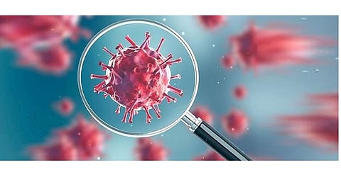 contractor will get salary from ZP