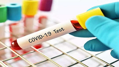 covid test.jpg