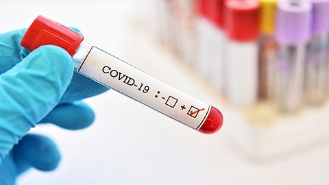 कोरोनाबाधितांचा आकडा दररोज वाढत चालला आहे. यामुळे संपूर्ण आरोग्य यंत्रणा आणि प्रशासनही हादरले आहे. हा आकडा नेमका कशामुळे वाढत आहे याचाही शोध घेतला जात आहे.