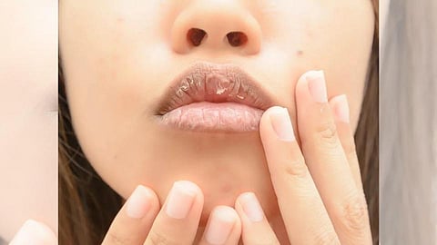 COVID Tongue : ओठांभोवती पाच लक्षणं जाणवल्यास कोरोना चाचणी नक्की करा