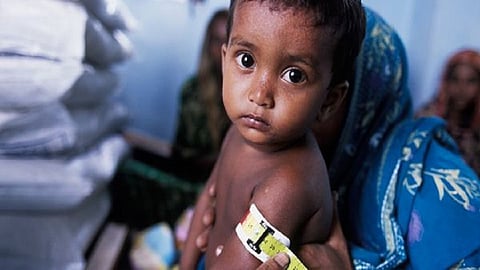 कोरोनामुळे कुपोषणात होणार वाढ; जागतिक पोषण अहवालात इशारा