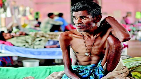 क्षयरुग्णांवर कुटुंबीयांचा अघोषित बहिष्कार