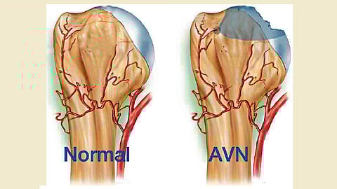 रक्त आणि हाडे