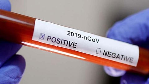 आंबेगाव तालुक्यात आढळला कोरोनाचा रुग्ण