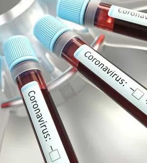 Solapur is not serious about Corona