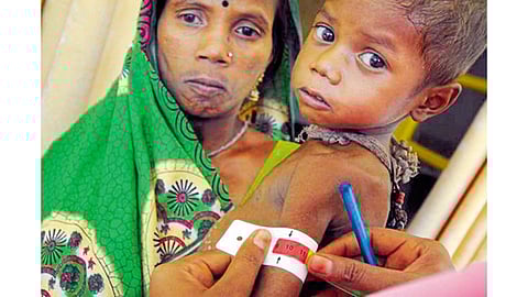 नंदुरबार जिल्ह्यात कुपोषणाचा विळखा होतोय सैल