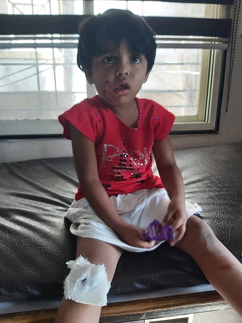 The five year girl of the accident in Velapur survives