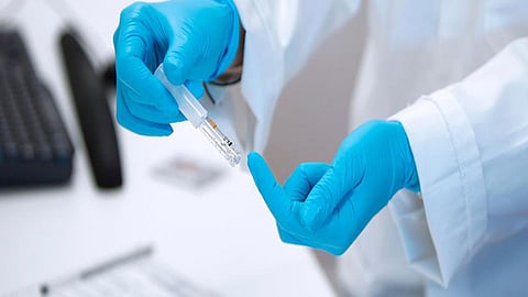 सातारा : जिल्हा रुग्णालयात मशिनअभावी मंदावतोय कोरोना तपासणीचा वेग