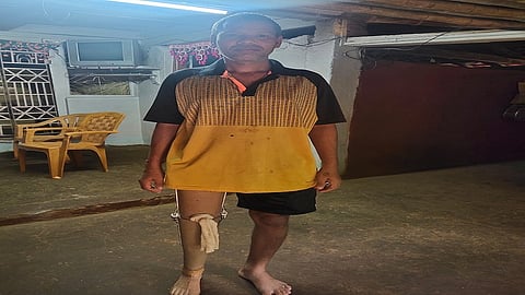 two businessman help a person who leave his leg in accident but they both help in operation of leg in konkan