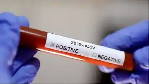 corona test compulsory for traveler come in nagpur