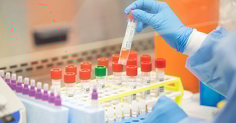 coronavirus impact konkan sindhudurg