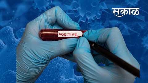 ‘जीएमसी’त पॉझिटिव्ह तर खासगीत ‘निगेटिव्ह’; कोरोना संशयितांच्या जिवाशी खेळ सुरूच !