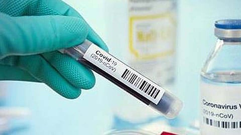 मावळात आज ८१ नवे पॉझिटिव्ह; सर्वाधिक रुग्ण लोणावळ्यात