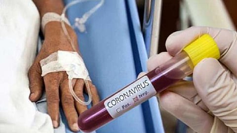 corona-virus-.jpg