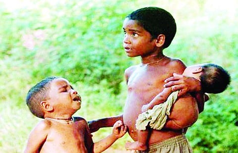 शंभर कोटींचा खर्च होऊनही कुपोषण कायमच!