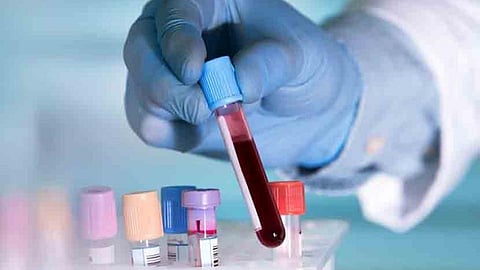 Satara Latest Marathi News