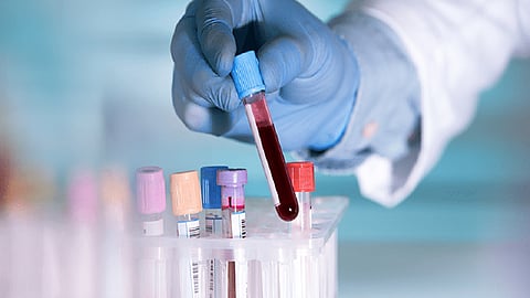 Fraud pathology labs in Achalpur Amravati district