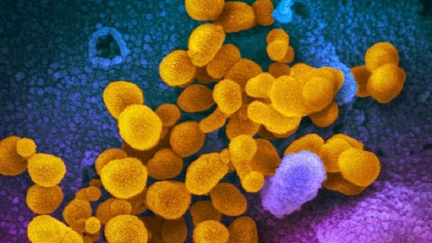 new fever spread in konkan named is sari and 18 people was dead in ratnagiri