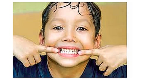 आपलेच दात...