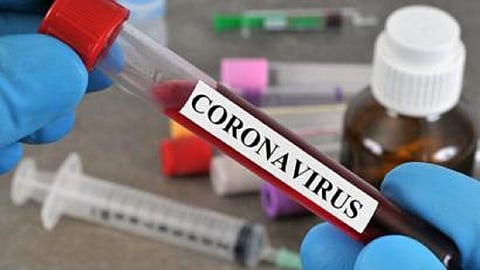 33 people were found to be corona positive In the a wholesale drug store in Sadashiv Peth.jpg