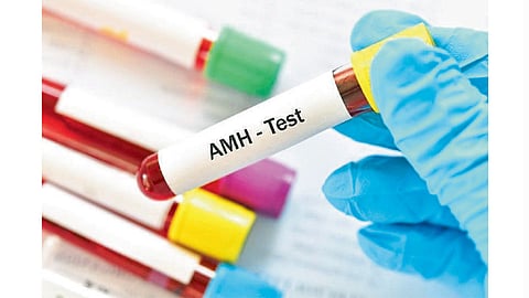 AMH-Test
