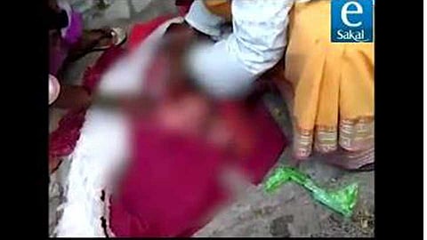 Alive baby girl dumped in the trash at Yerawada in Pune