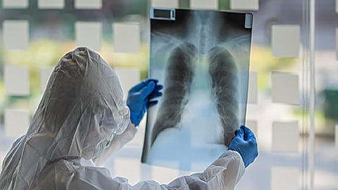 Easy to diagnose Covid 19 by X-ray - Software developed by DIAT,Pune