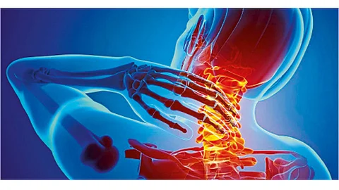 Neck-Pains