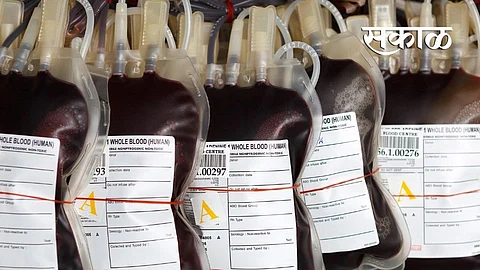 9570 blood bags collected during lockdown period in Yavatmal