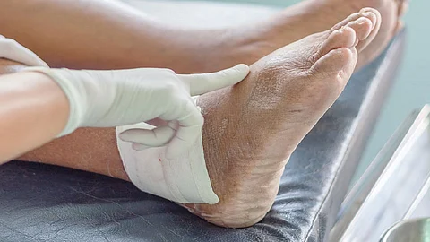 URIC ACID 1.jpg