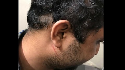 पुन्हा पुन्हा तेच घडतंय, कायदे केलेत तरीही तेच... हे थांबणार की नाही ?