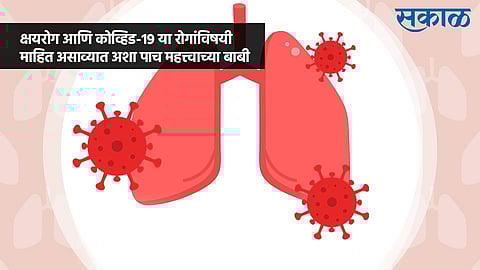 क्षयरोग आणि कोव्हिड-१९ या रोगांविषयी माहित असाव्यात अशा 'पाच' महत्त्वाच्या बाबी