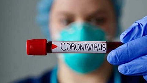 Corona Updates : पिंपरी-चिंचवड शहरात दिवसभरात 23 जणांचा मृत्यू