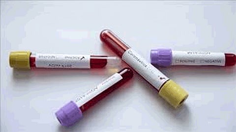 Corona Swabs report will now be available on mobile