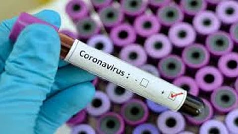 coronavirus-2-1580265226.