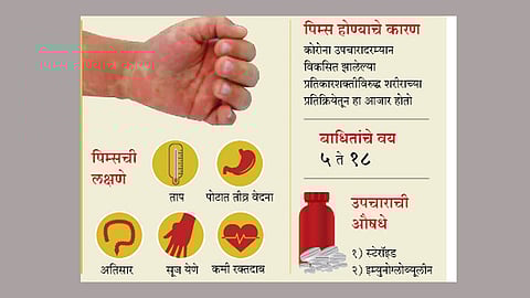 कोरोनानंतर मुलांमधील "पिम्स' आजारासंबंधी डॉक्टरांचा सल्ला वाचा सविस्तर