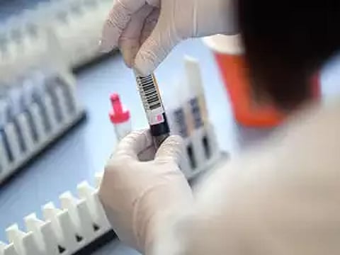 "प्लाझ्मा थेरपी'साठी जळगाव रेडक्रॉसचा "ऍक्शन प्लॅन'