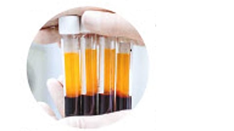 plasma theropy