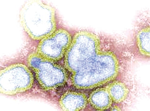 sari virus