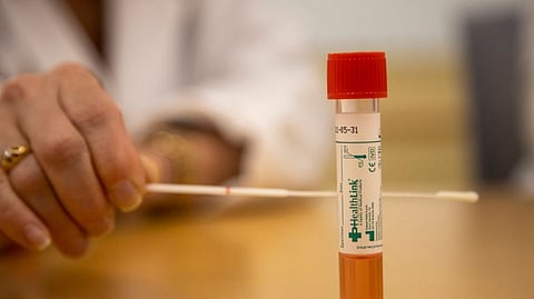 Corona test is now in Amarawati also