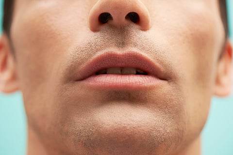 Struggling With Dry, Chapped Lips? These Lips Balms Might Just Be For You!